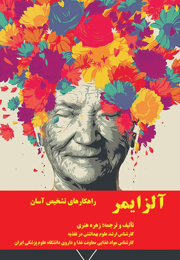 آلزایمر